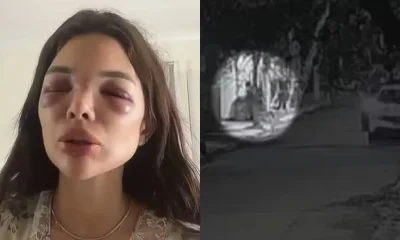 Fantástico exibe vídeo de agressão de empresário da Faria Lima contra dentista
