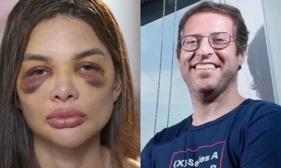 Dentista relata novas acusações de violência sexual e física contra o ex-marido empresário