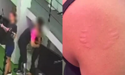 Instrutor que mordeu professora em academia no Recife se defende: 'Atitude lúdica'