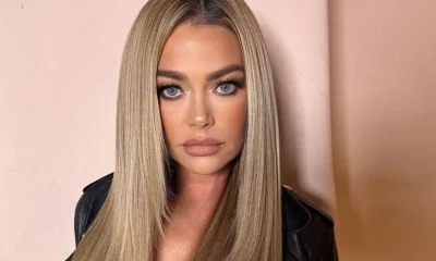 Denise Richards, 55 anos, choca com resultado de facelift e revela detalhes inéditos sobre cirurgia plástica no rosto