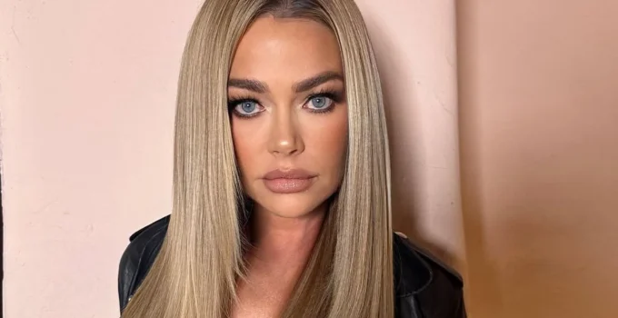 Denise Richards, 55 anos, choca com resultado de facelift e revela detalhes inéditos sobre cirurgia plástica no rosto