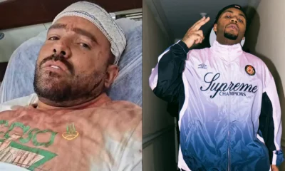 Influencer Afrodisíaco Surge Ferido Após Agressão de Orochi em Boate e Detona: 'Estão Tirando de Contexto'