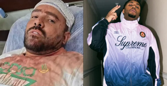 Influencer Afrodisíaco Surge Ferido Após Agressão de Orochi em Boate e Detona: 'Estão Tirando de Contexto'