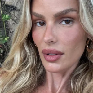 Yasmin Brunet Choca ao Revelar Perda de 25kg Após Diagnóstico de Lipedema: '25 kilos a menos!'