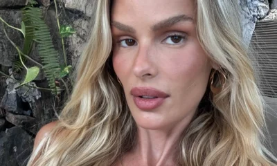 Yasmin Brunet Choca ao Revelar Perda de 25kg Após Diagnóstico de Lipedema: '25 kilos a menos!'