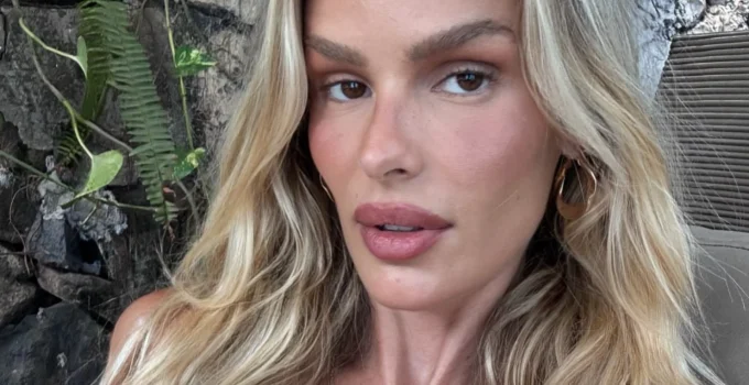 Yasmin Brunet Choca ao Revelar Perda de 25kg Após Diagnóstico de Lipedema: '25 kilos a menos!'