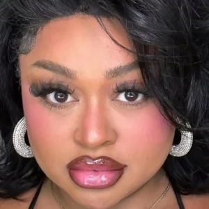 Ex-BBB Rízia Cerqueira sofre acidente de moto e choca ao mostrar hematomas e revelar causa misteriosa; vídeo revela detalhes