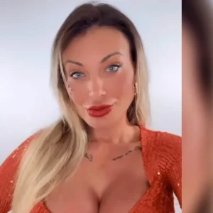 Andressa Urach mostra novo rosto após 50ª cirurgia plástica e revela valor milionário: "Queria um rosto novo após divórcio"