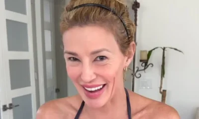 Brandi Glanville revela retorno de misterioso parasita que afetou seu rosto