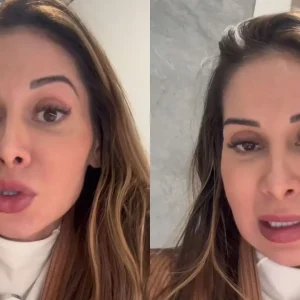 Maíra Cardi expõe deformidades no rosto após procedimento com PMMA e alerta: 'É para vocês acordarem'