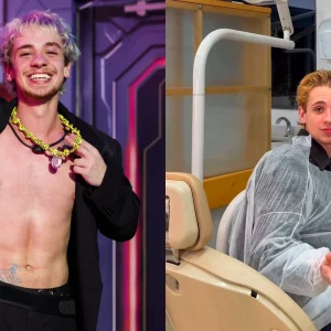 Juliano Floss desmente rumor de mau hálito com exame ao vivo; veja resultado